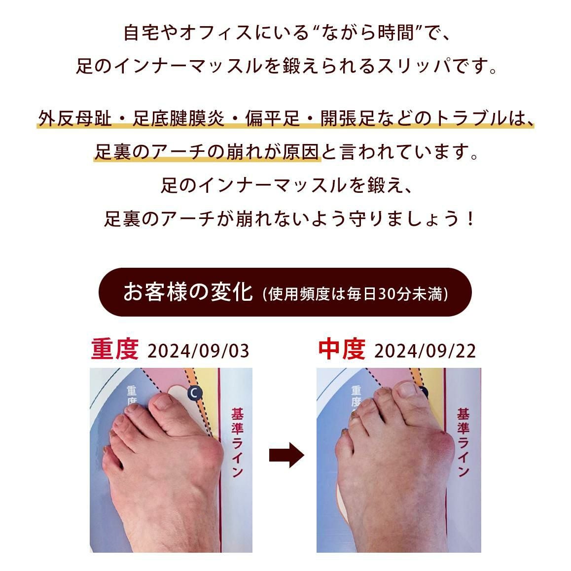 ドクターホワイル トレーニング 健康スリッパ サンダル 健康サンダル グーパー ブルーグレー L 足 指 トレ 体幹 姿勢 Belle＆Sofa（ベルアンドソファ） ダイエットスリッパ 健康サンダル